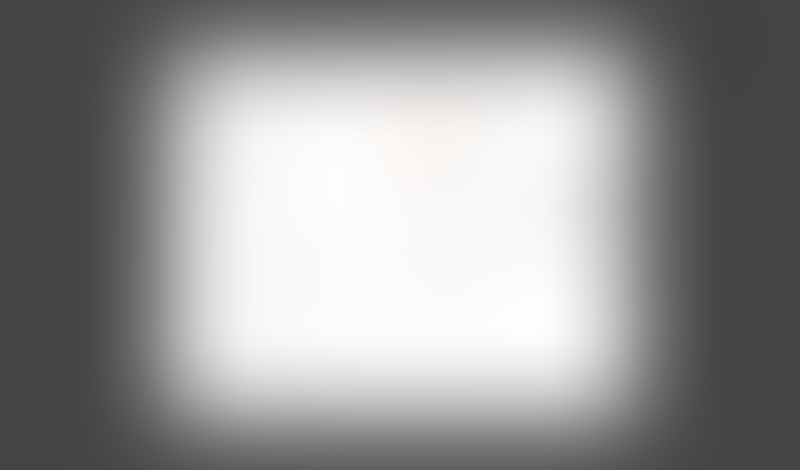 Freckle
			           ux ui design