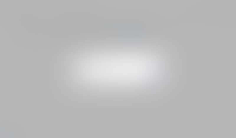 Freckle
			     ux ui design