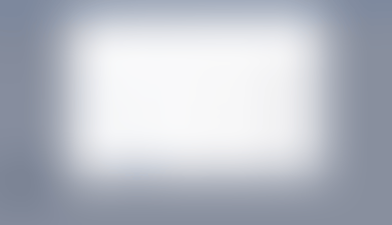 Causal
			               ux ui design