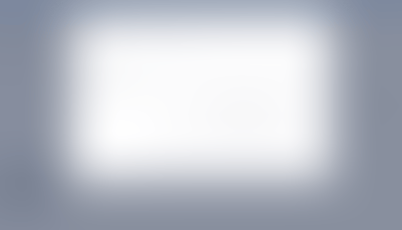 Causal
			              ux ui design