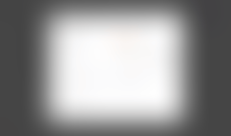 Freckle
			          ux ui design