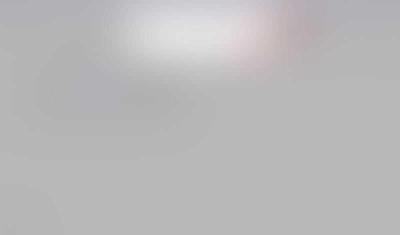 Freckle
			       ux ui design