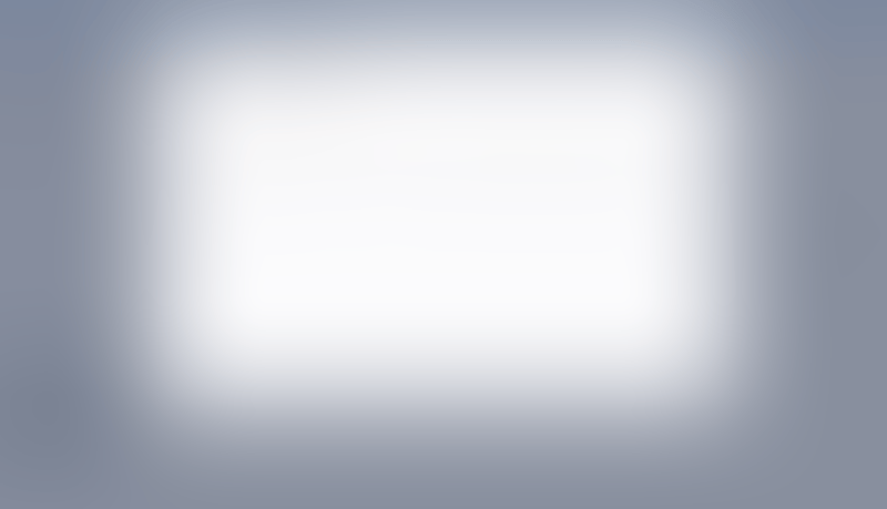 Causal
			           ux ui design