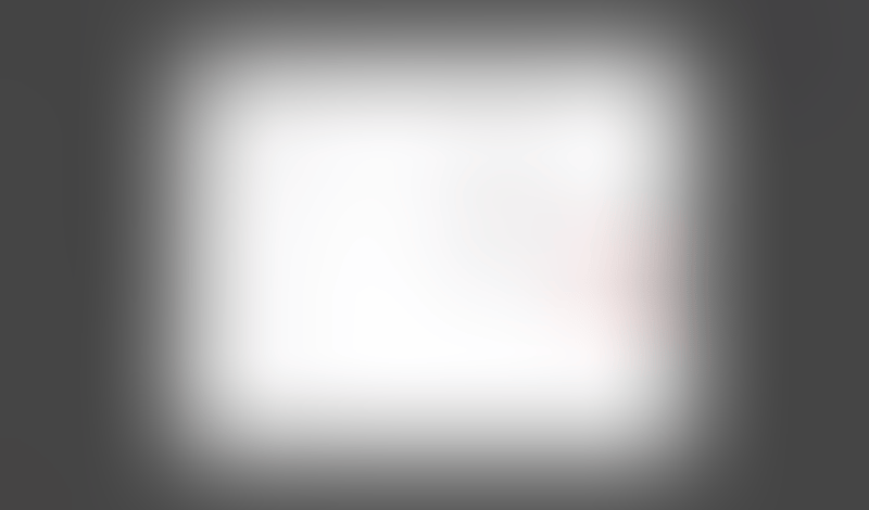 Freckle
			        ux ui design