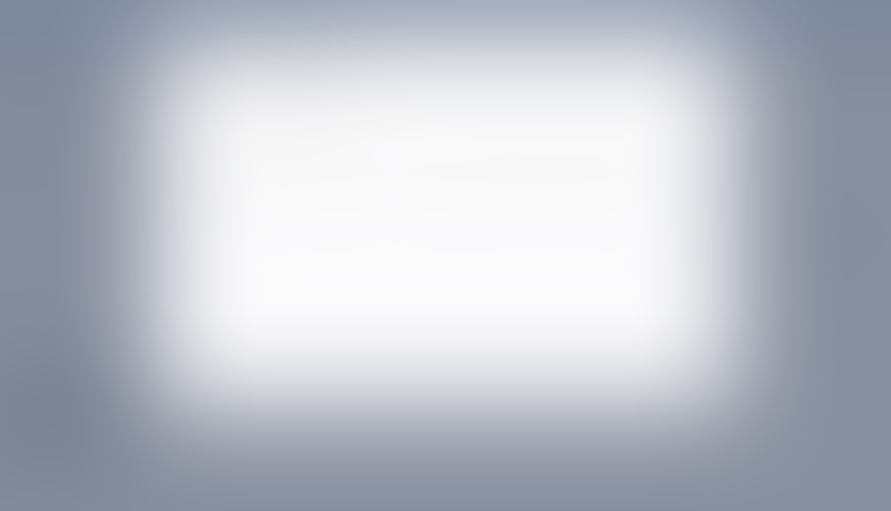 Causal
			          ux ui design