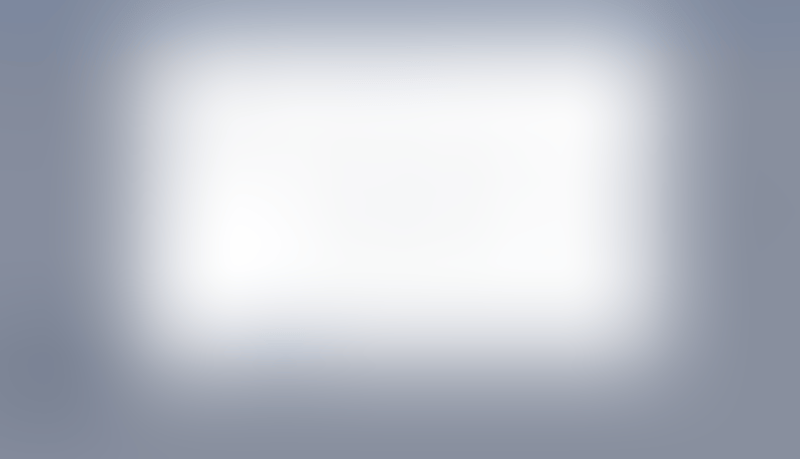 Causal
			              ux ui design