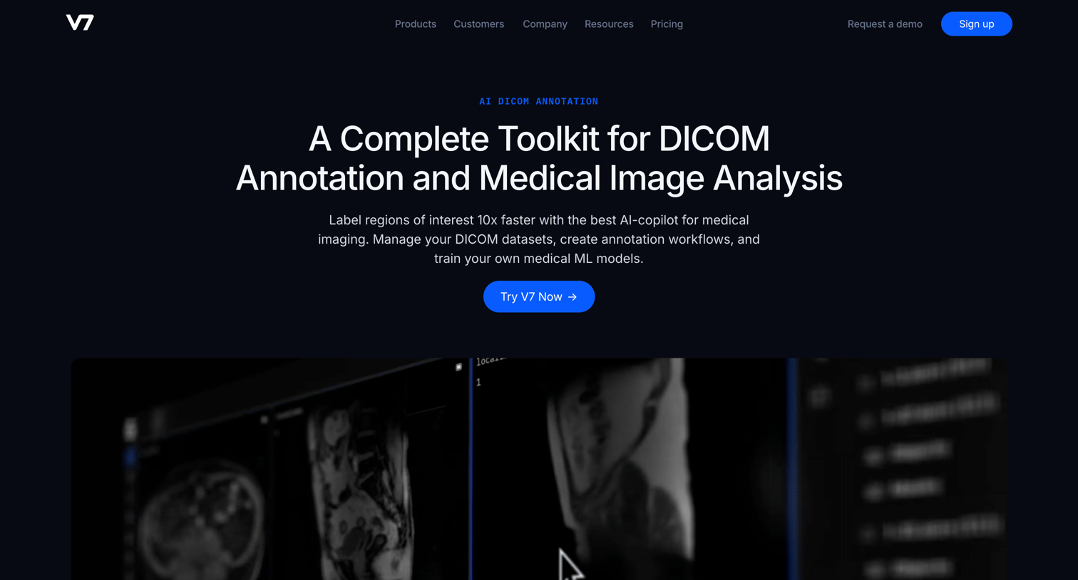 V7 - V7 DICOM Annotation Tools Annotate DCM Files Online screen