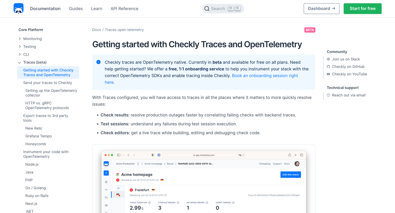 Checkly - Getting started with Checkly Traces and OpenTelemetry screen